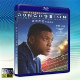 腦震蕩 /震蕩效應 Concussion /Game Brain (2015)  -藍光影片50G